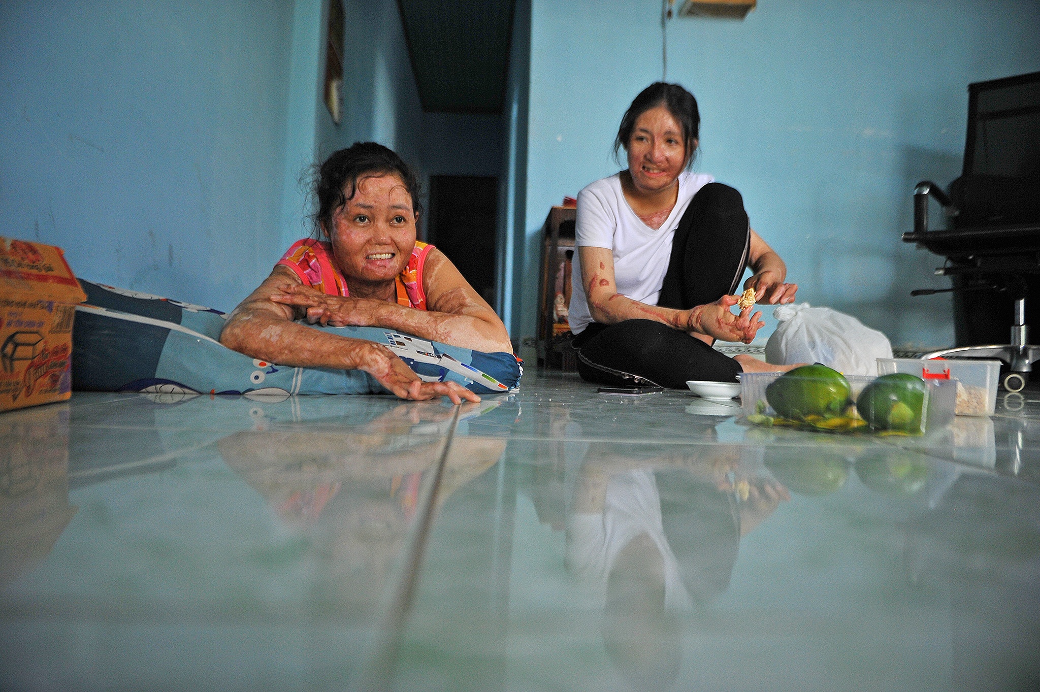 vo bi chong tuoi xang dot anh 12