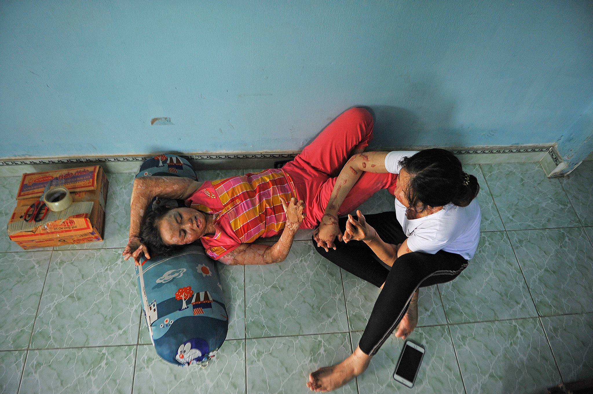 vo bi chong tuoi xang dot anh 10