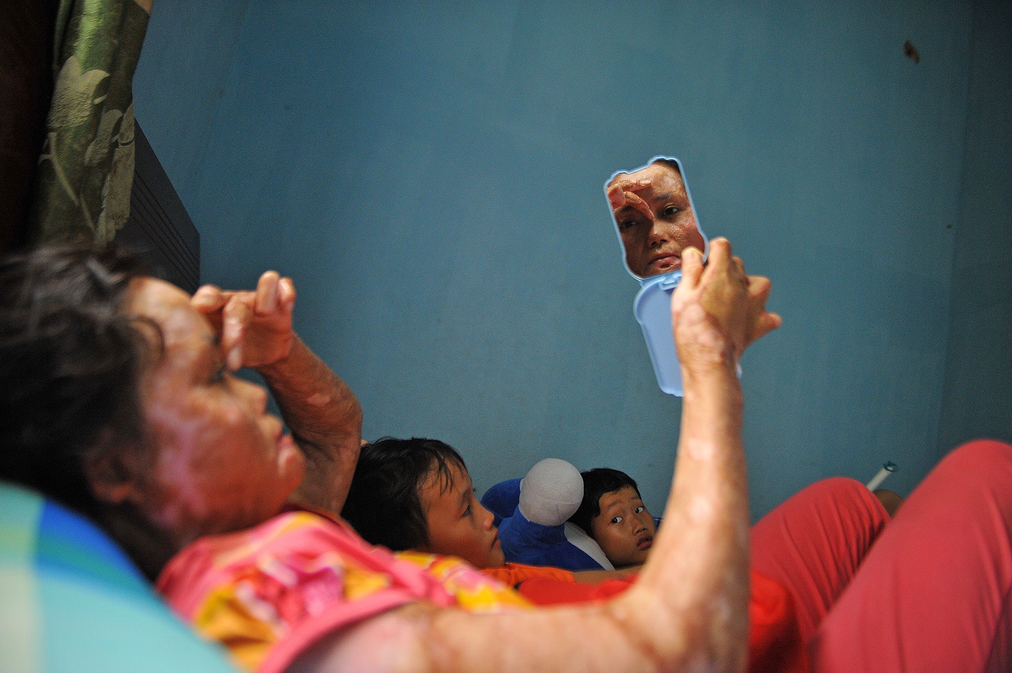 vo bi chong tuoi xang dot anh 8