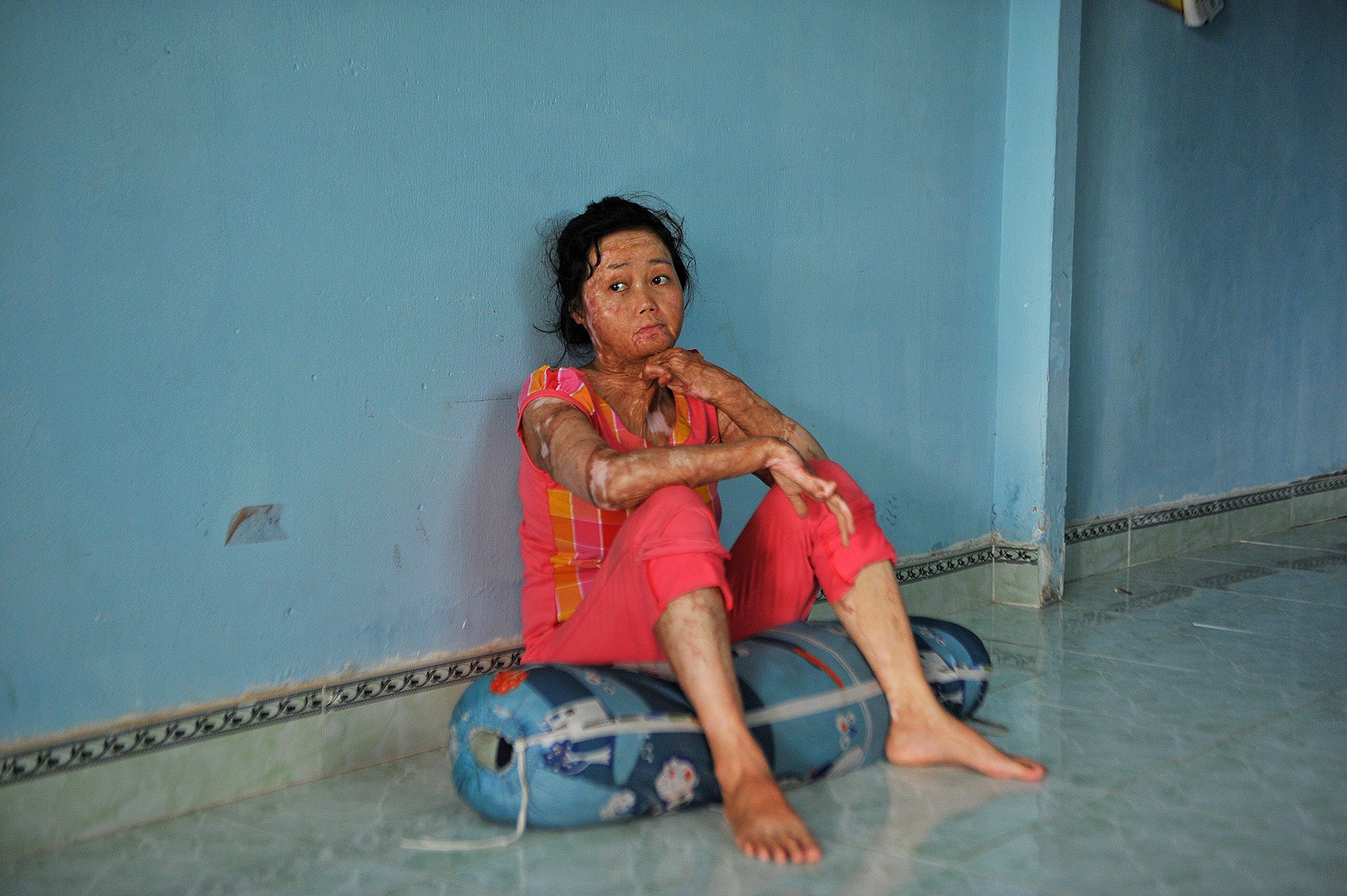 vo bi chong tuoi xang dot anh 6