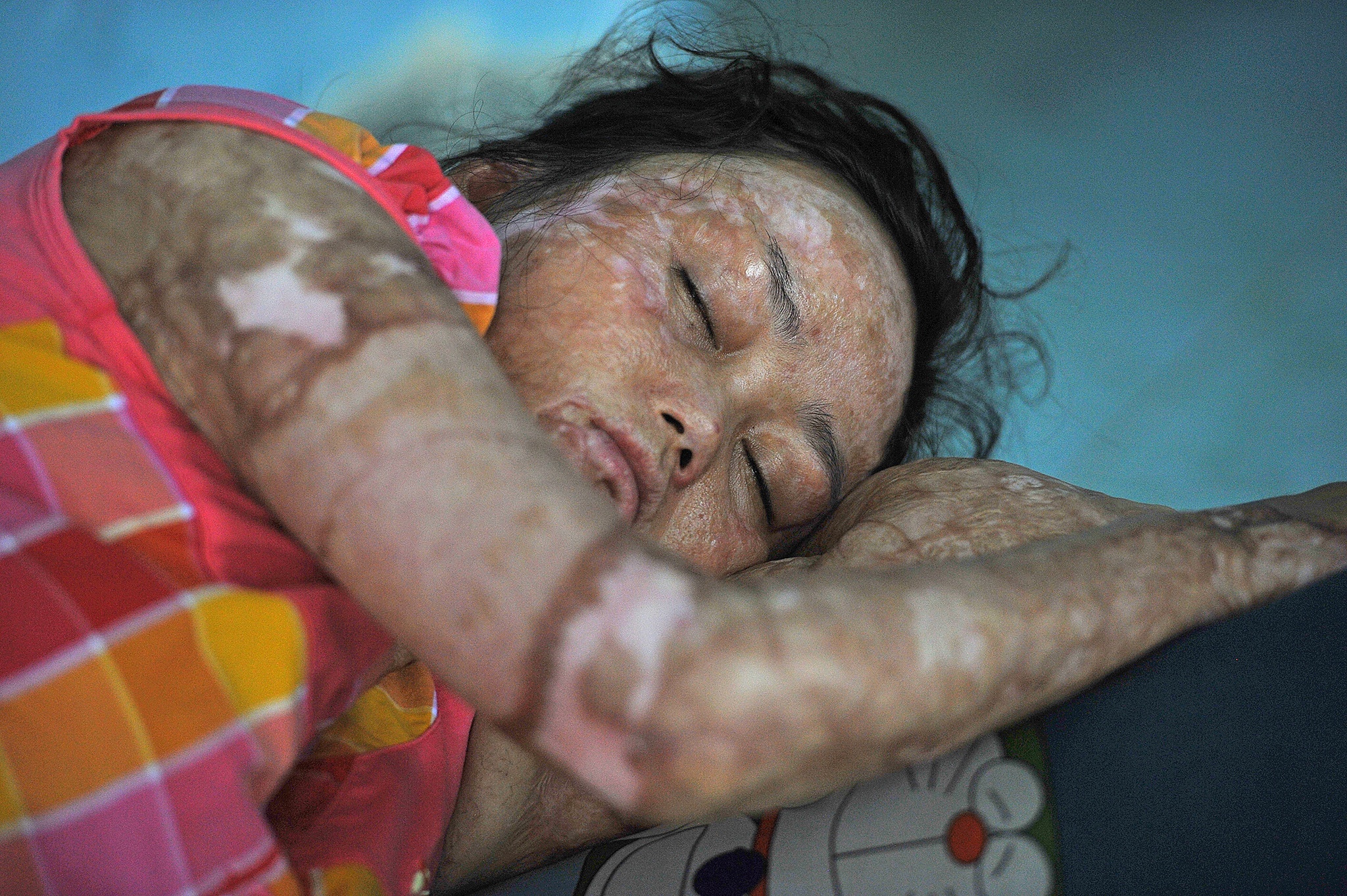 vo bi chong tuoi xang dot anh 4