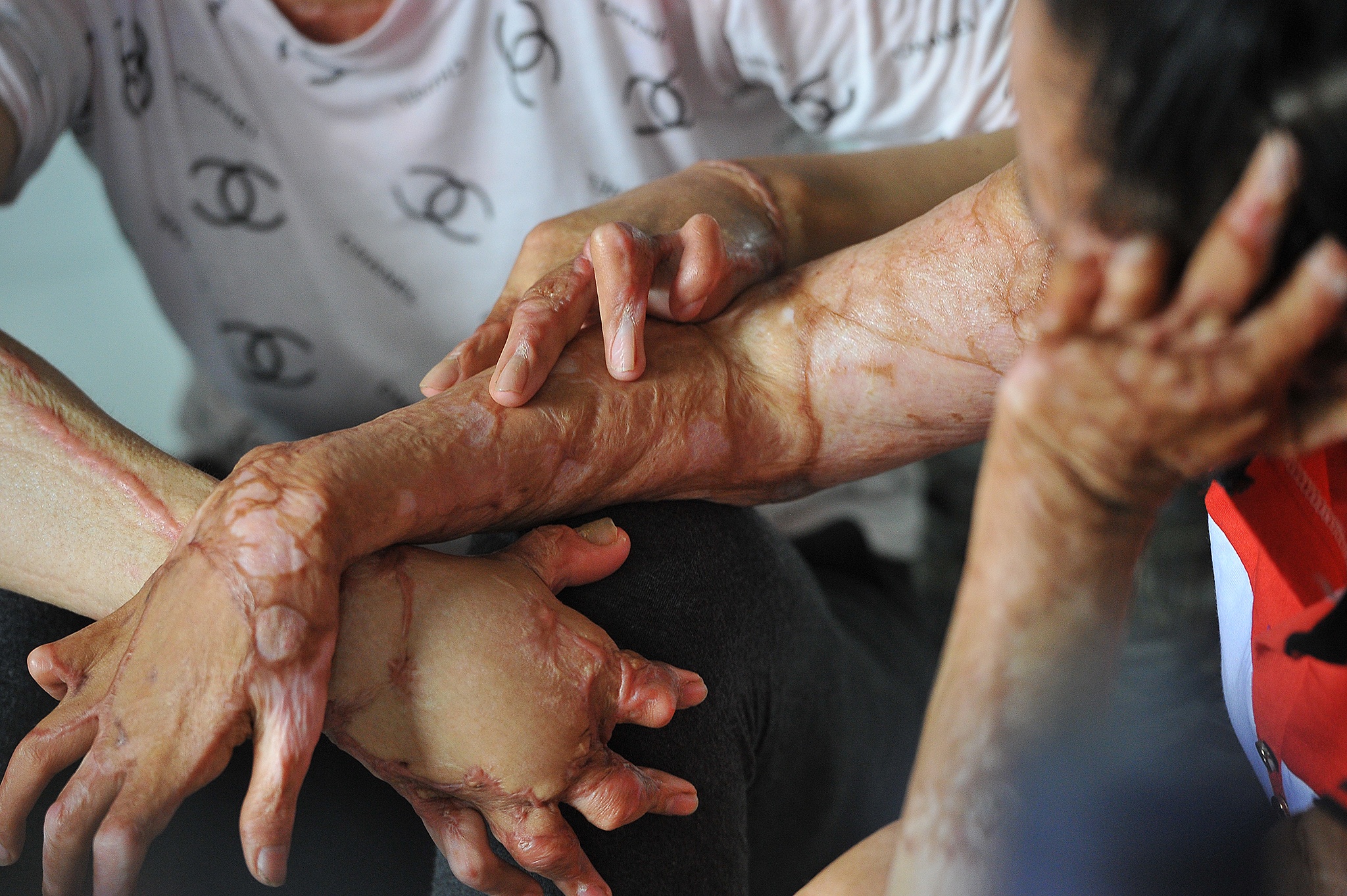 vo bi chong tuoi xang dot anh 5