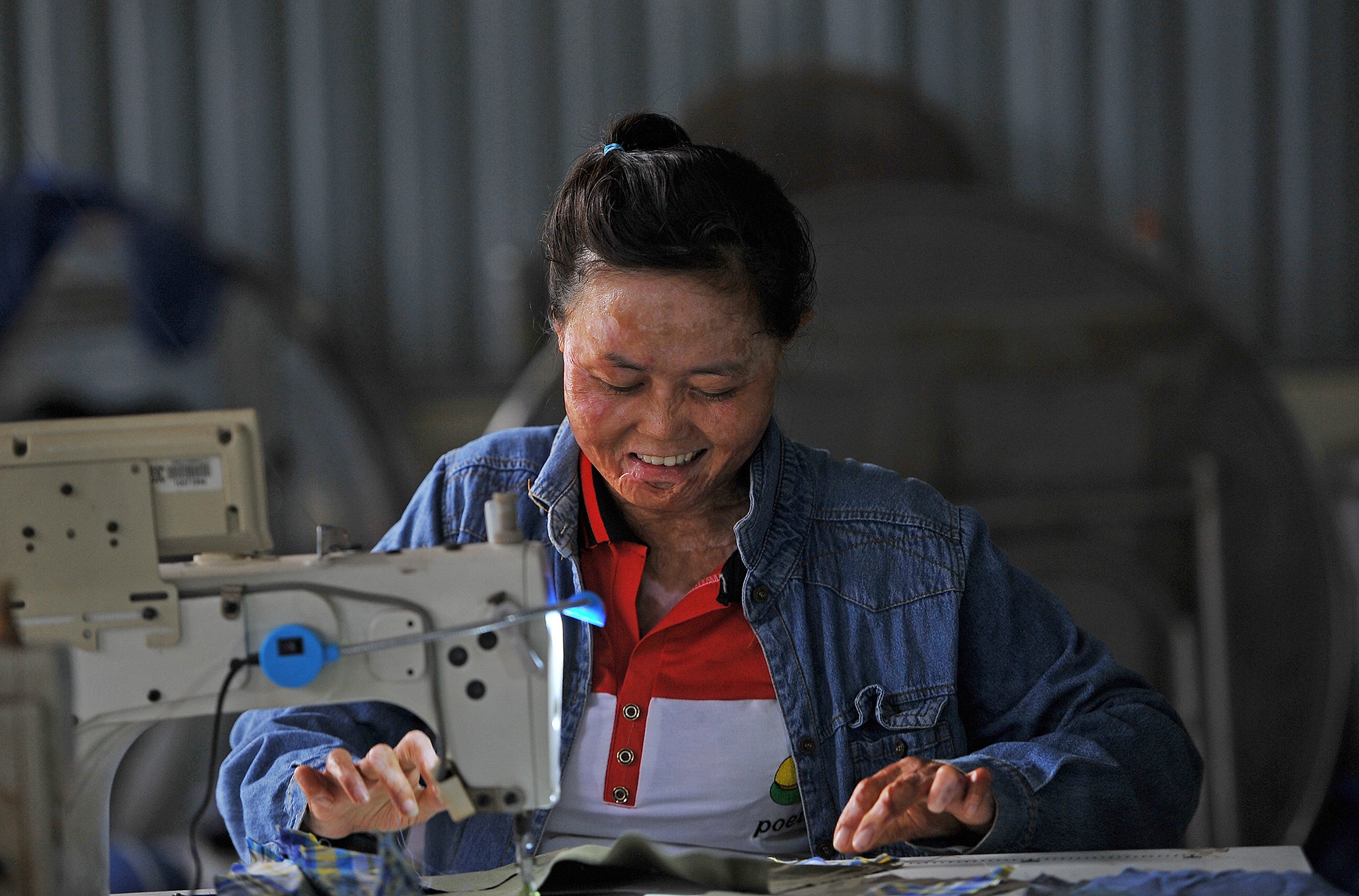 vo bi chong tuoi xang dot anh 25