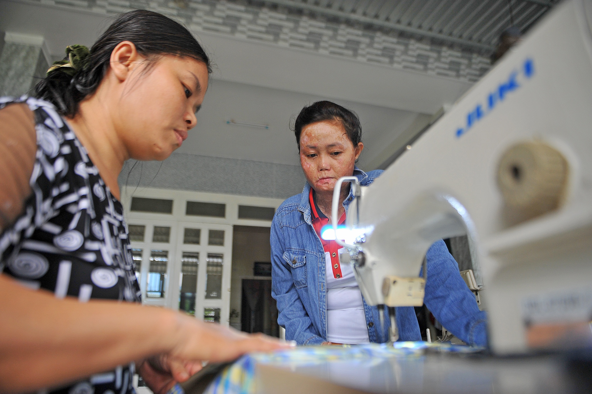 vo bi chong tuoi xang dot anh 36