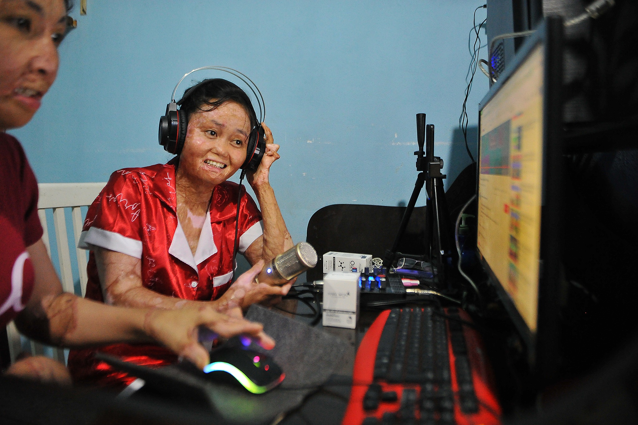 vo bi chong tuoi xang dot anh 13