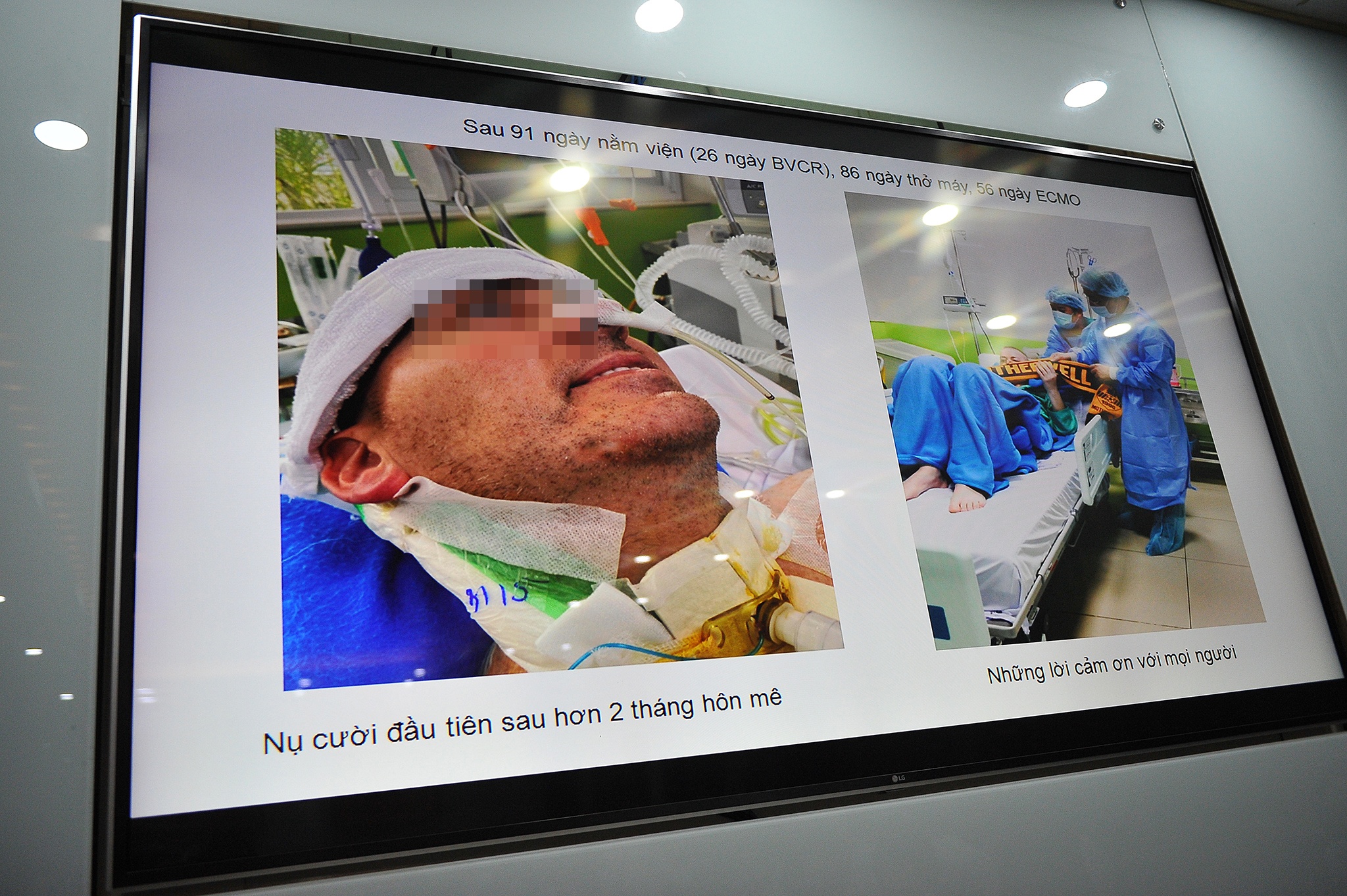 Benh nhan nguoi Anh nhiem Covid-19 co the xuat vien anh 9