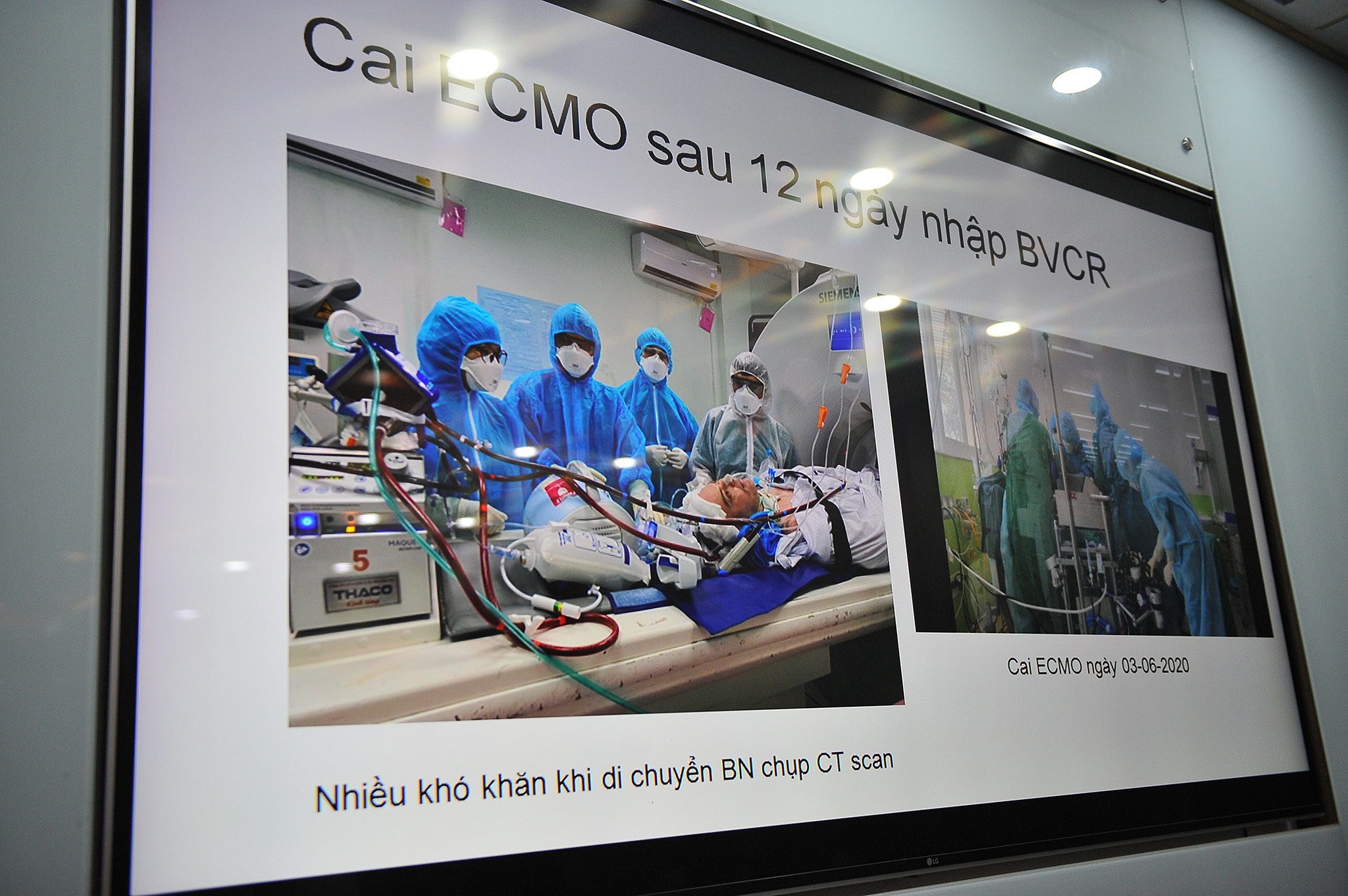 Benh nhan nguoi Anh nhiem Covid-19 co the xuat vien anh 8