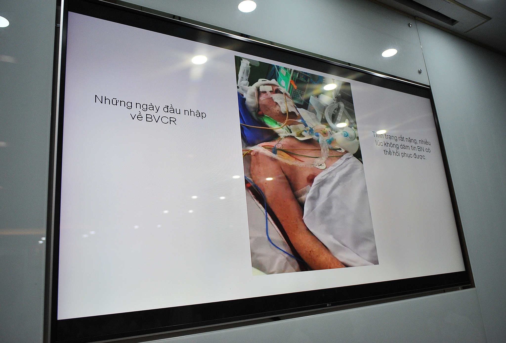 Benh nhan nguoi Anh nhiem Covid-19 co the xuat vien anh 1