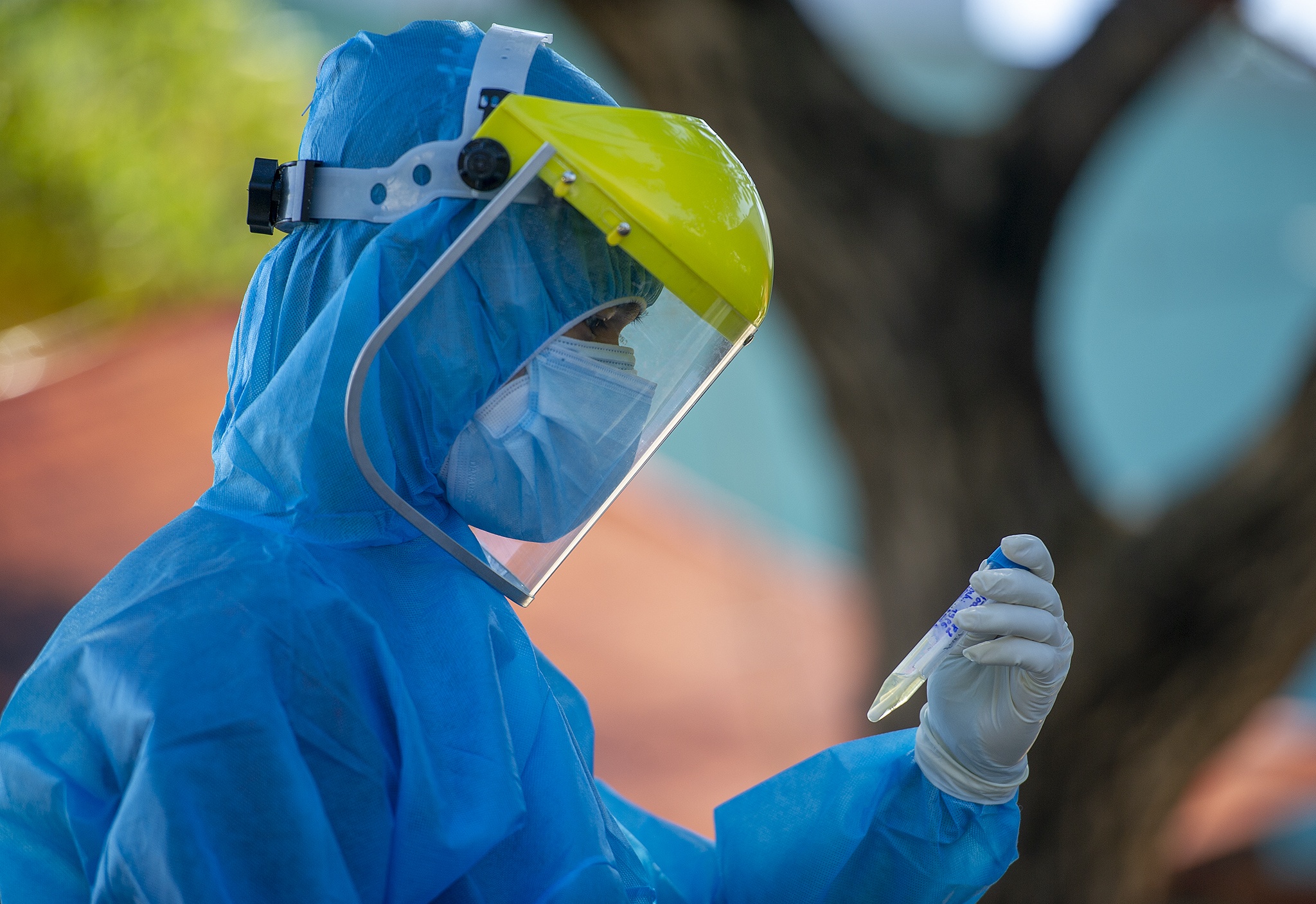 Xet nghiem Covid-19 trong cong dong anh 8