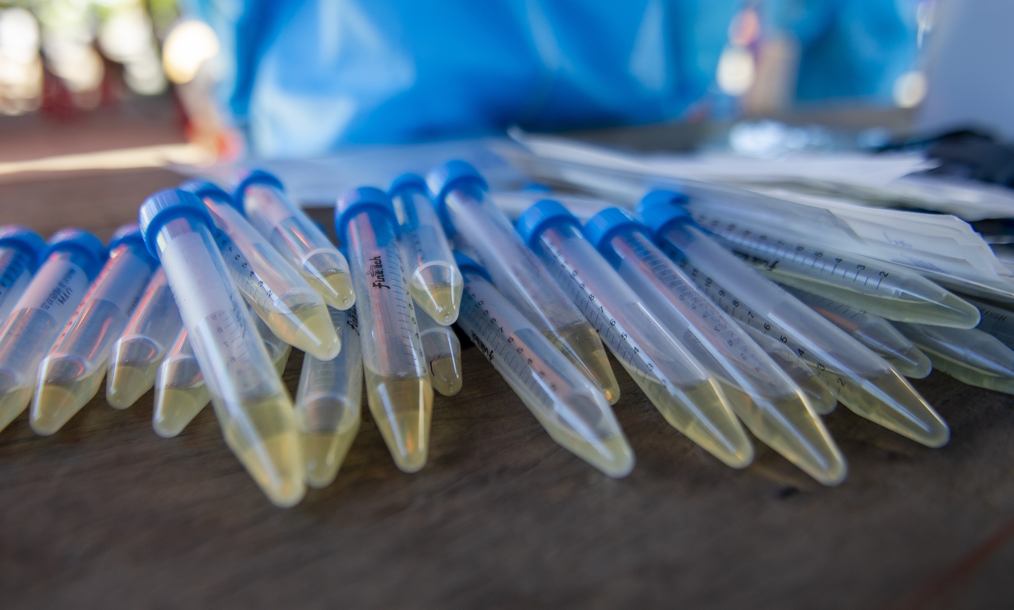 Xet nghiem Covid-19 trong cong dong anh 10