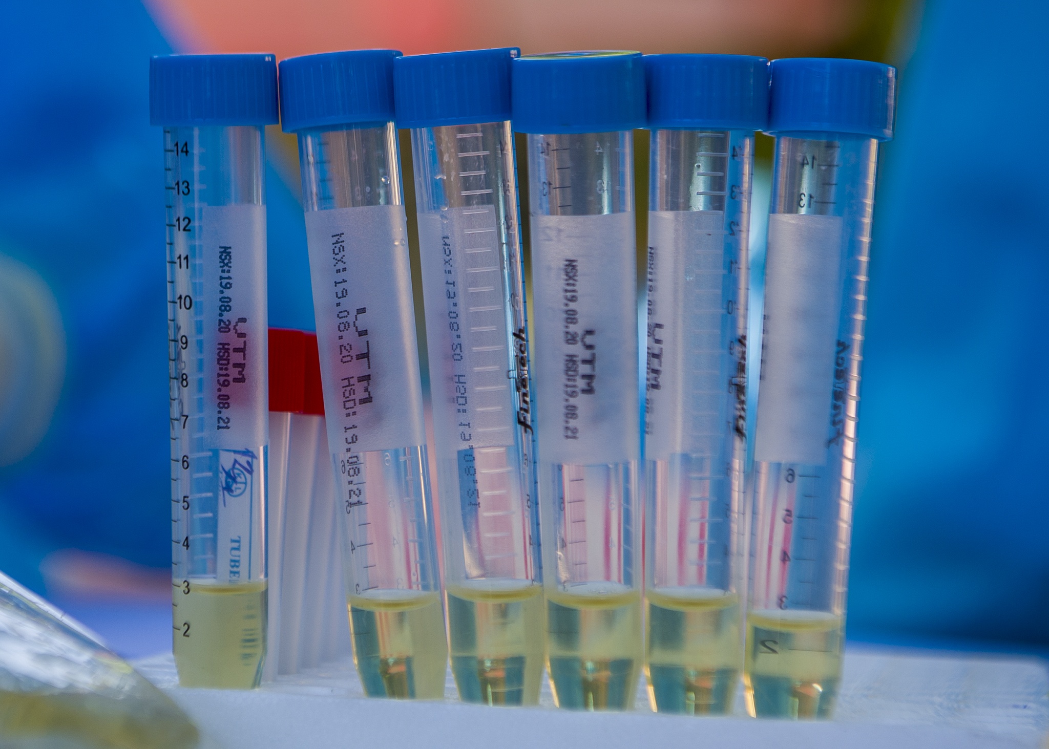 Nghin nguoi nuoc ngoai xet nghiem Covid-19 anh 12