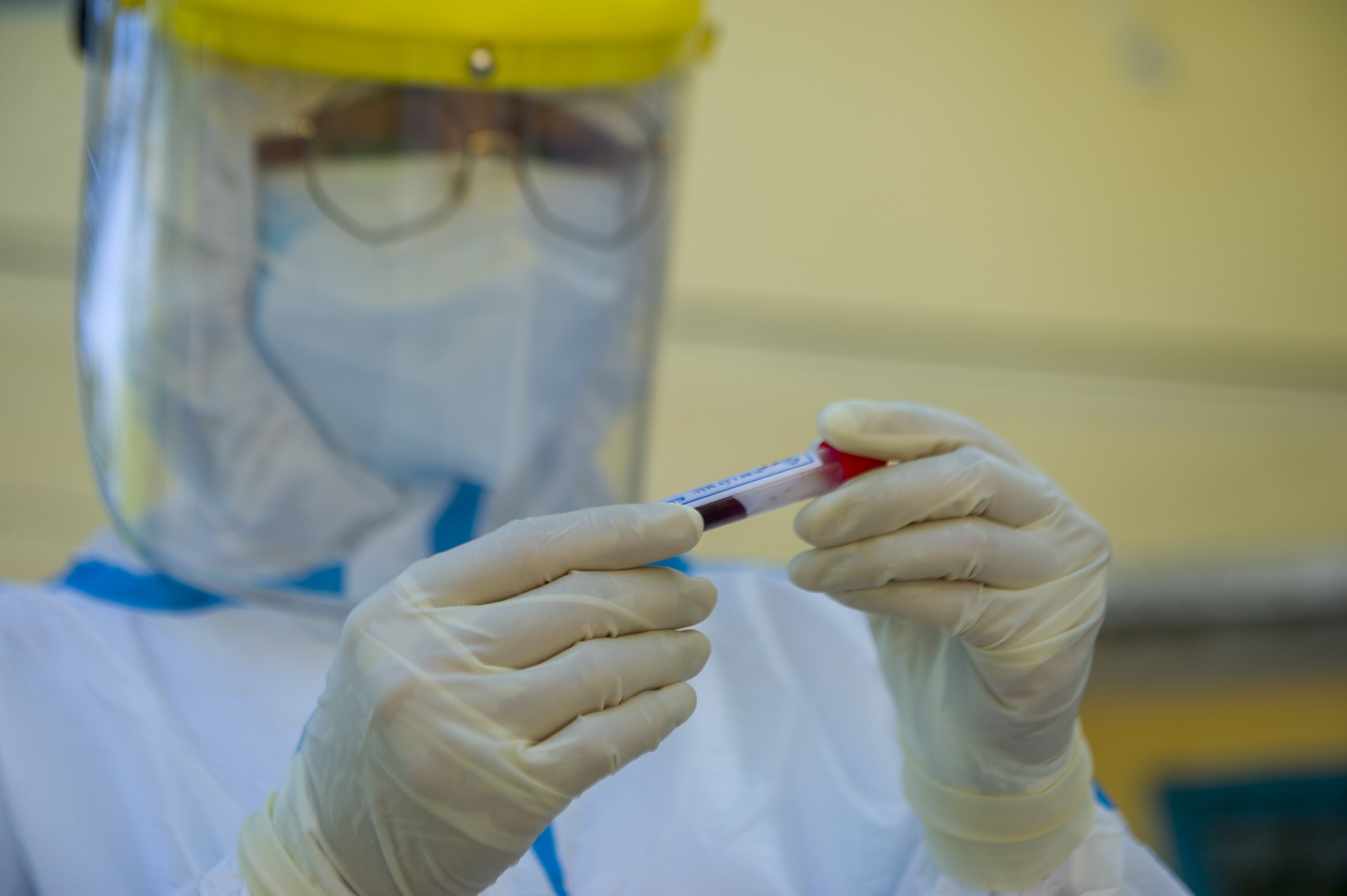 Nghin nguoi nuoc ngoai xet nghiem Covid-19 anh 11