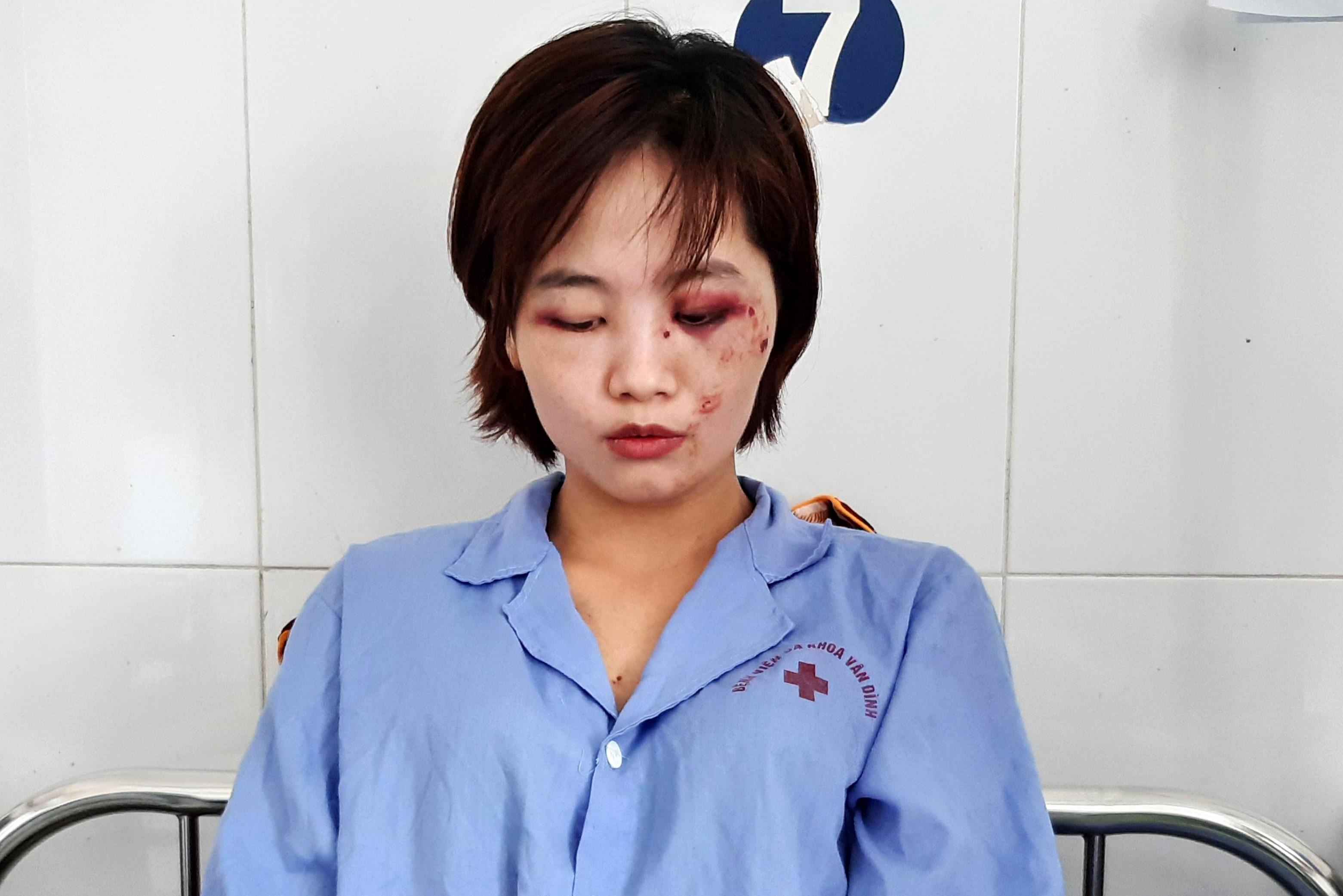 Nu phu xe buyt ke lai giay phut bi 5 thanh nien danh nhap vien hinh anh