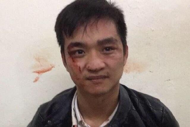 Nam thanh nien vao tiem vang giat day chuyen hinh anh