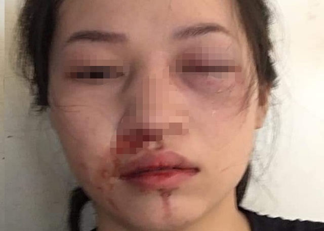 CSGT bi to vut gay vao mat nguoi vi pham hinh anh