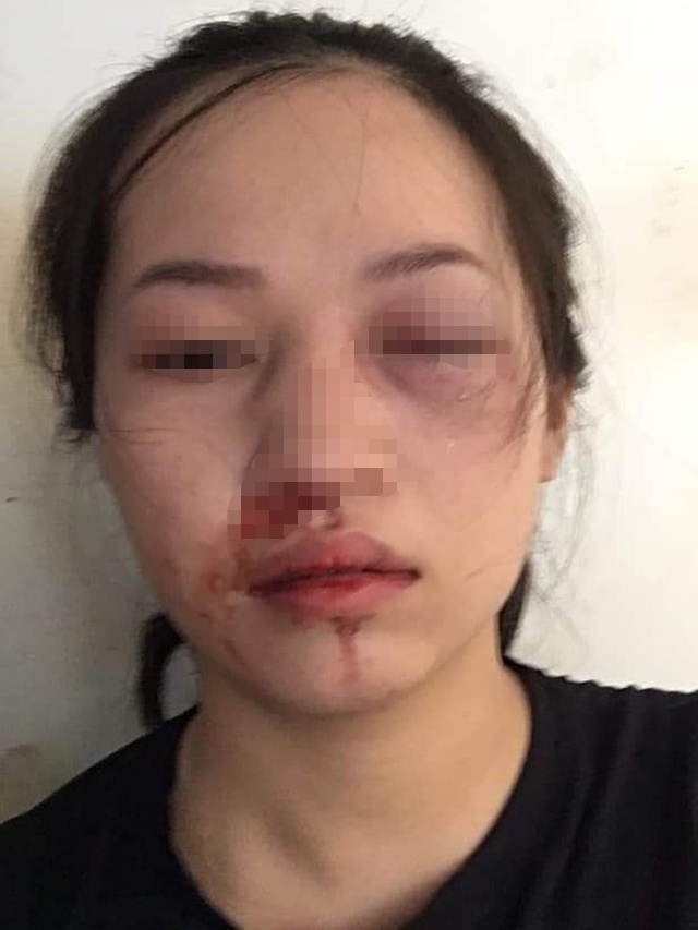 CSGT Tuyen Quang danh nguoi anh 1