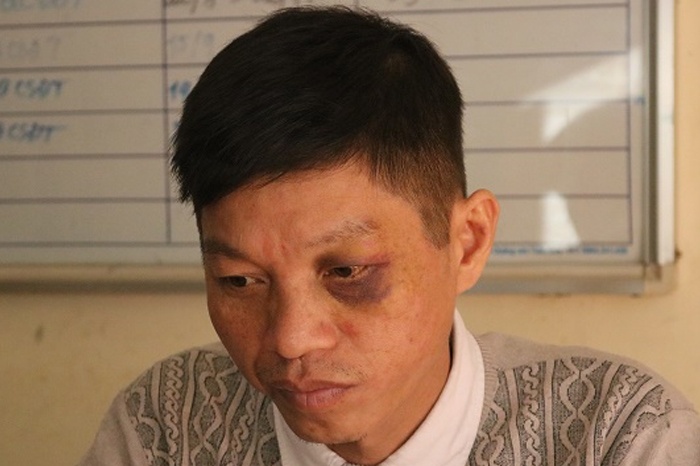 Khoi to tai xe tan cong canh sat giao thong hinh anh