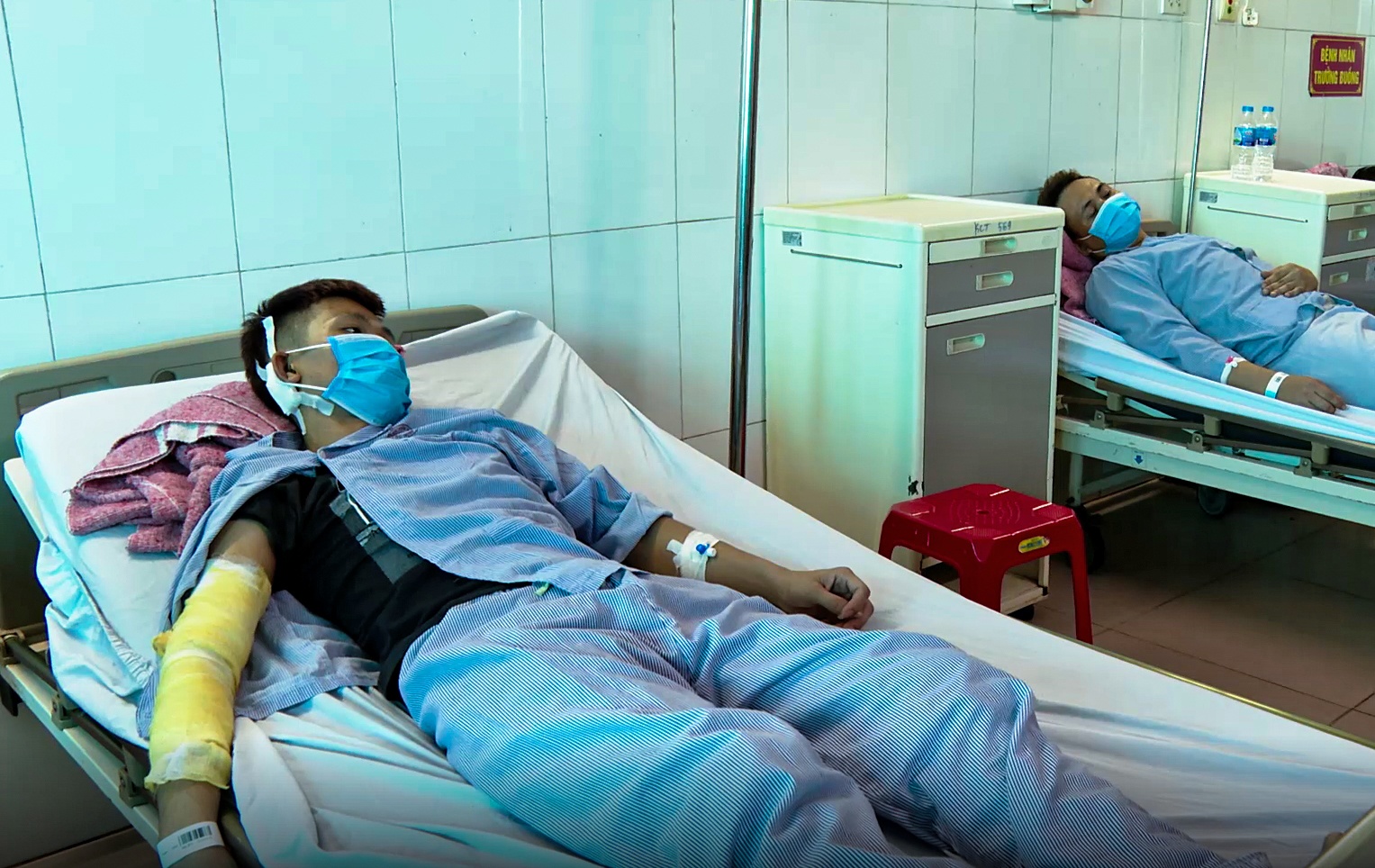 no 34 nguoi bi bong anh 1