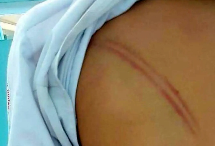 Xac minh vu me ke o Ca Mau danh con chong hang chuc vet bam tim hinh anh