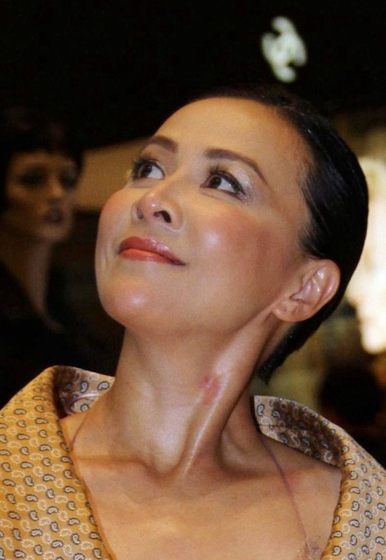 Luu Gia Linh nhu mac vay ngu lo vet 'yeu' hinh anh