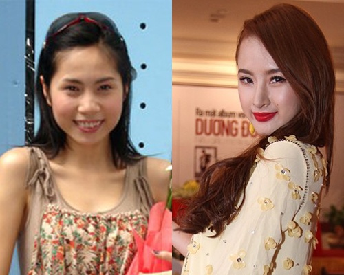 Nhung nguoi dep Viet tu tin thua nhan 'dao keo' hinh anh