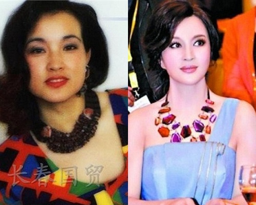 Luu Hieu Khanh lo nhan sac chua phau thuat tham my hinh anh