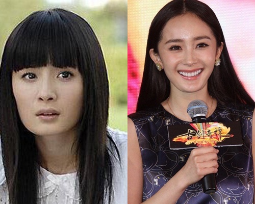 Nhung sao Hoa ngu xau di vi phau thuat tham my hinh anh