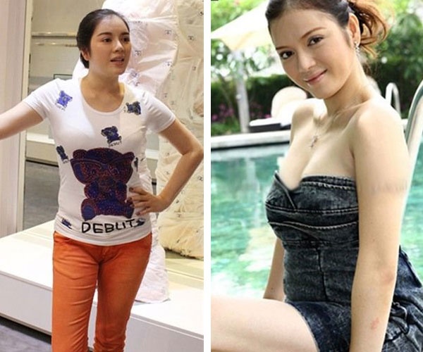 Soi diem yeu tren co the sao Viet hinh anh