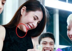 Thuy Tien lo dau vet don cam hinh anh