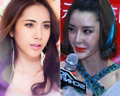 Nhung sao xau - dep khi phau thuat tham my hinh anh