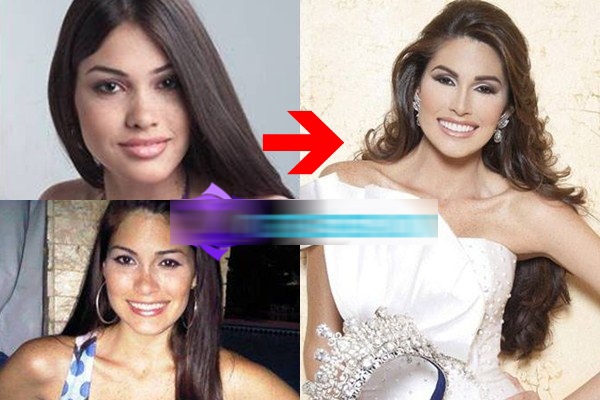 4 'hoa hau dao keo' Venezuela gay that vong hinh anh