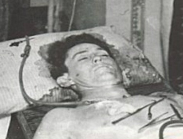 Ly Tieu Long dot tu vi cu diem huyet 'hen gio chet' hinh anh