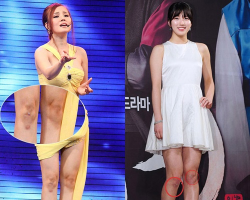 Doi chan ‘hoa gam’ xau xi cua sao nu chau A hinh anh