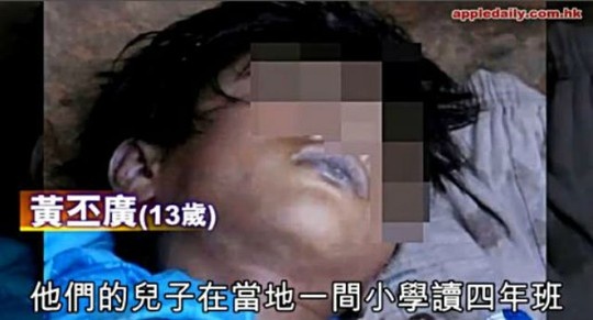Thi thể nam sinh Huang Pi-guang bầm tím và có nhiều vết sẹo. 