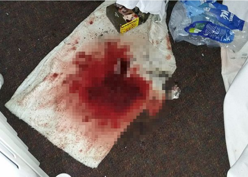 Nghe don dep hien truong vu an anh 5