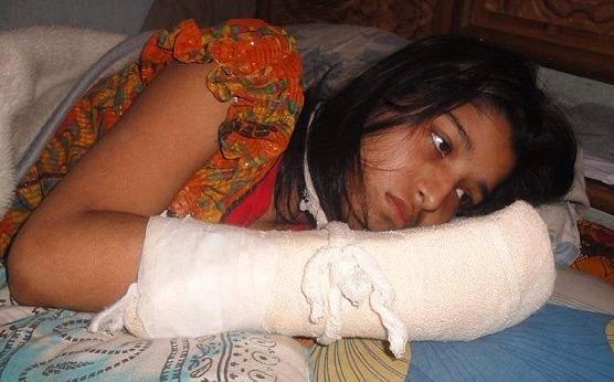 Nguoi vo o Bangladesh bi chong cat lia ngon tay vi muon di hoc hinh anh