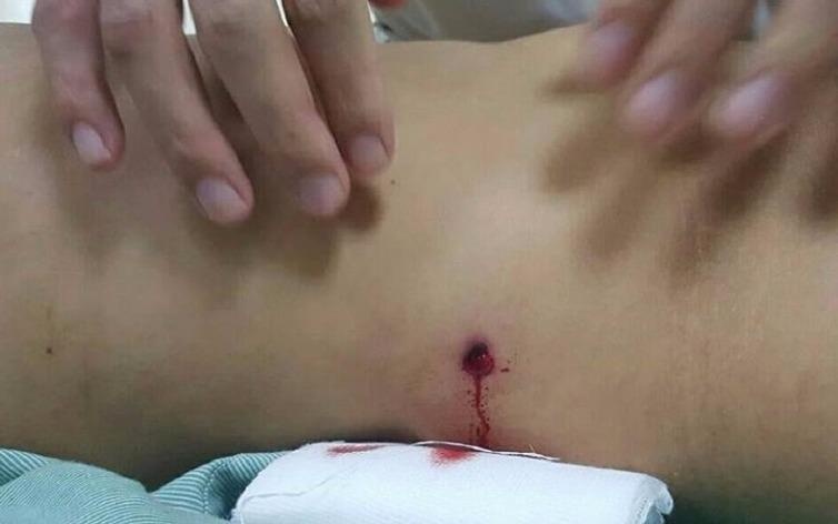 Dang di duong, nguoi phu nu bi dan ban thung bung hinh anh