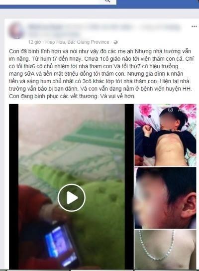 Bao hanh tre em anh 1