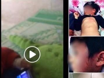 Be 4 tuoi bi bam tim toan than sau khi den lop hinh anh