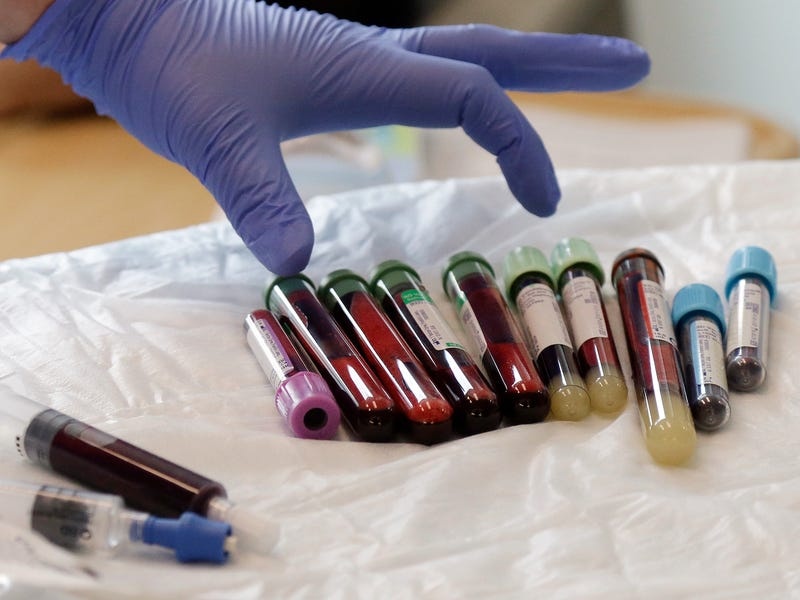 chi phi cac can benh o My anh 9