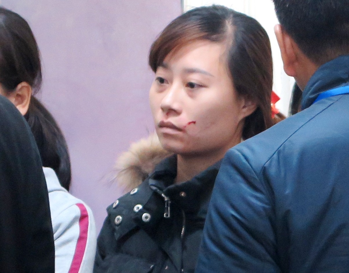 Nguoi than bi cao va nan nhan danh nhau tai toa hinh anh