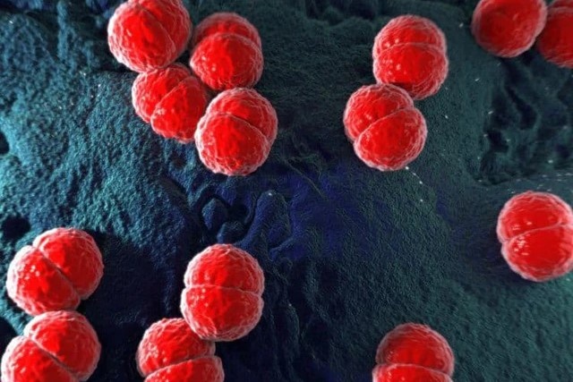 Nhung dieu can biet ve benh do nao mo cau hinh anh