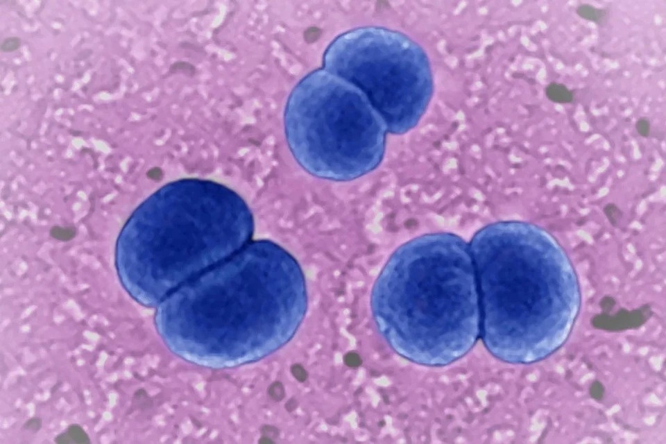 'Benh tu 24 gio' khien nguoi phu nu o TP.HCM khong qua khoi hinh anh