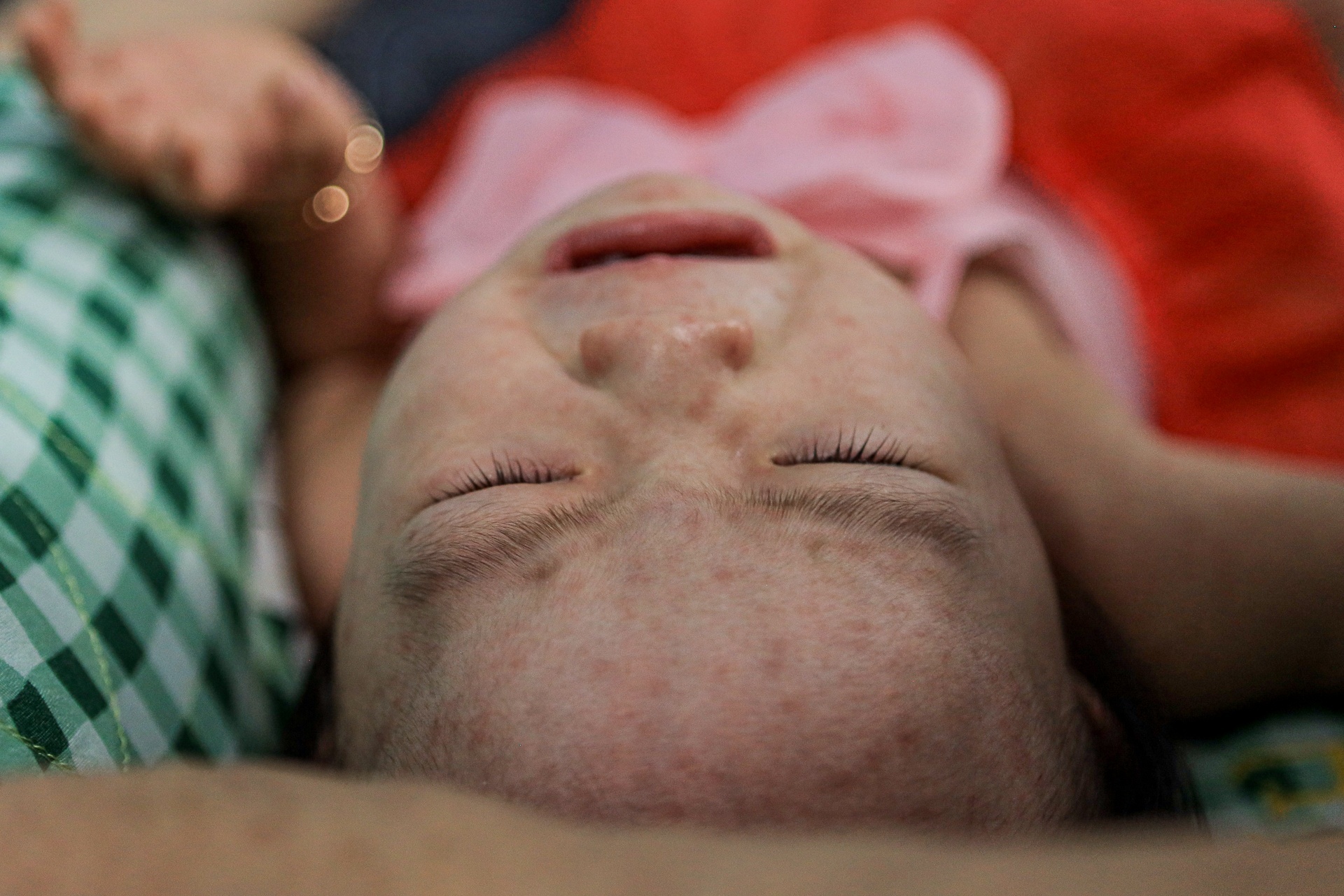 Phan biet benh soi va sot phat ban hinh anh