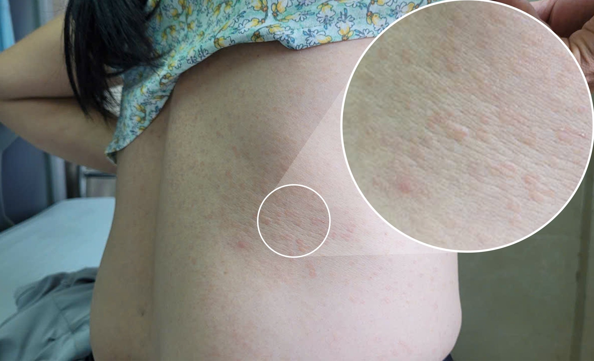 Ngua ngay suot 2 nam, nguoi phu nu bat ngo khi biet ly do hinh anh