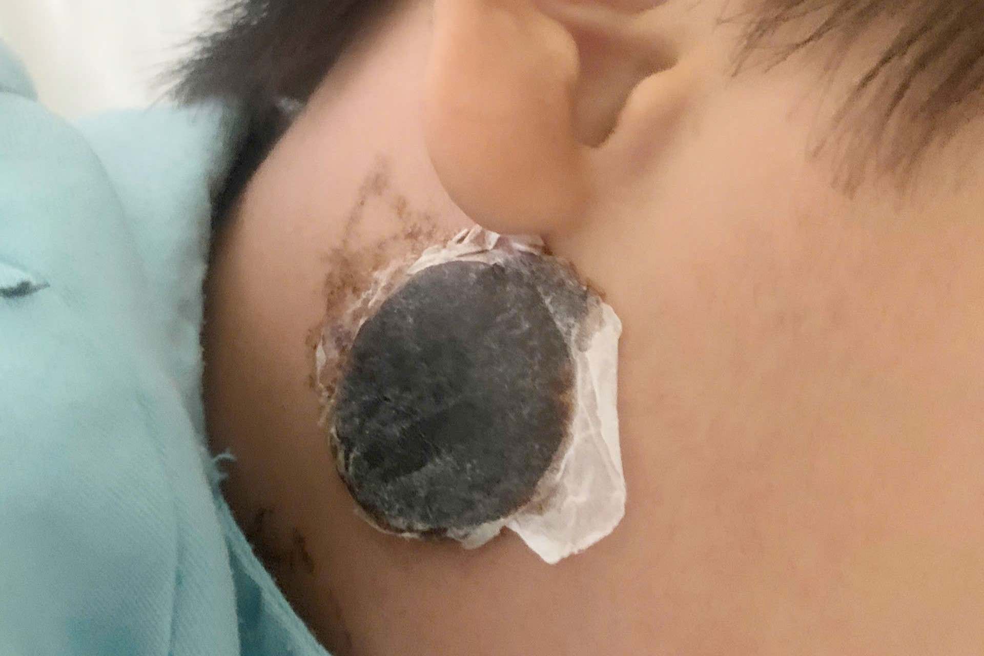 Mot sai lam khi ha sot khien be trai nhap vien da viem mang nao hinh anh