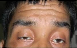 Bac si Benh vien Nhan dan 115 dieu tri ca benh rat hiem gap hinh anh