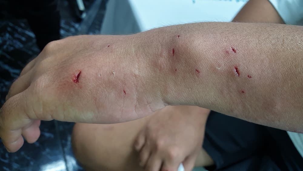 Hon 4 thang bi cho can, nguoi dan ong ra di trong tiec nuoi hinh anh