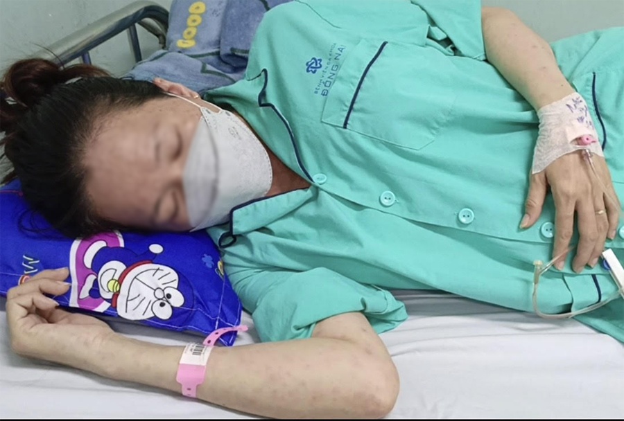 Benh soi 'tan cong' nguoi lon hinh anh