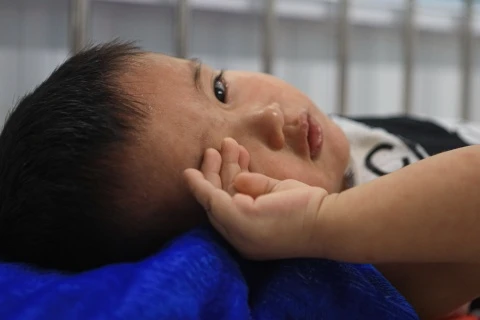 Tre duoi 9 thang tiem vaccine soi co an toan khong? hinh anh